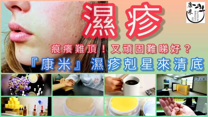 濕疹治療翻發，頑固難好，二十多年中醫臨床怎樣處理？